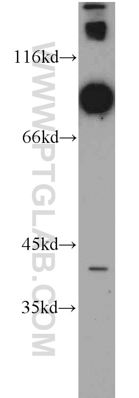 Western Blot (WB) analysis of human brain tissue using DNAI1 Polyclonal antibody (12756-1-AP)