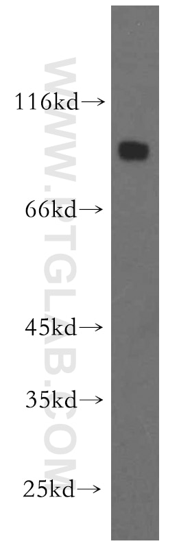 Western Blot (WB) analysis of human brain tissue using DNAI1 Polyclonal antibody (12756-1-AP)