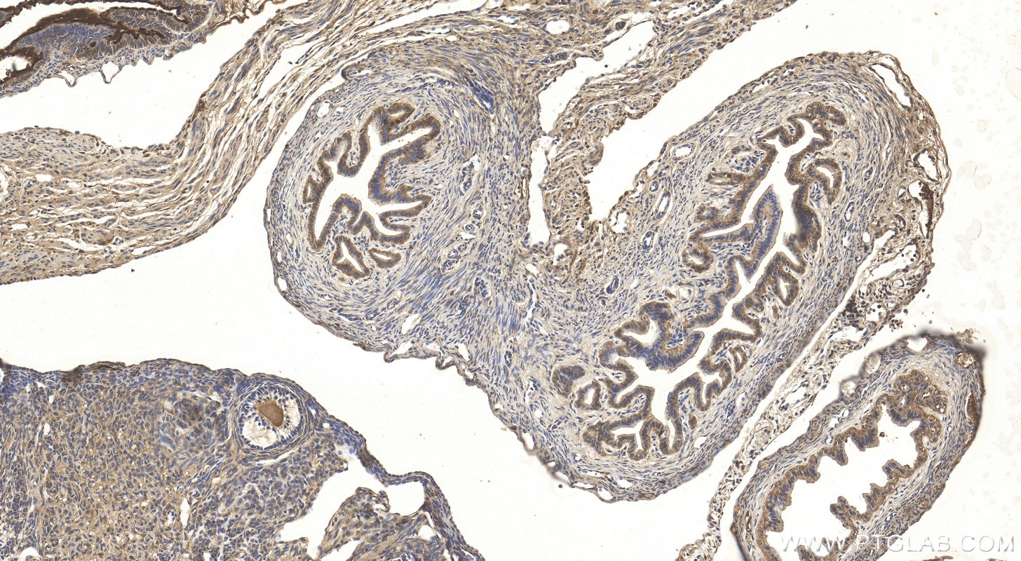 Immunohistochemistry (IHC) staining of mouse ovary tissue using DNAI2 Polyclonal antibody (17533-1-AP)