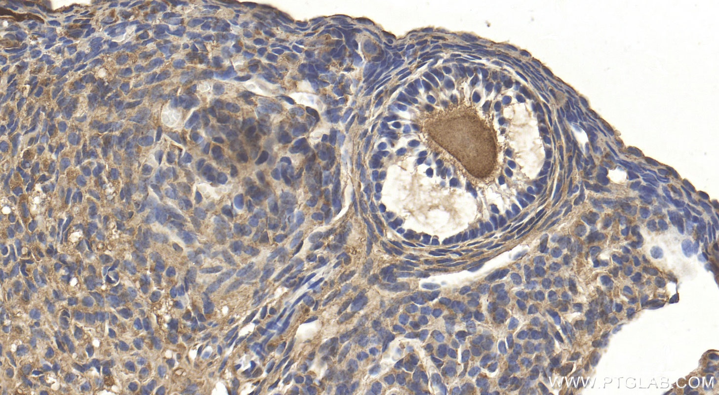 Immunohistochemistry (IHC) staining of mouse ovary tissue using DNAI2 Polyclonal antibody (17533-1-AP)