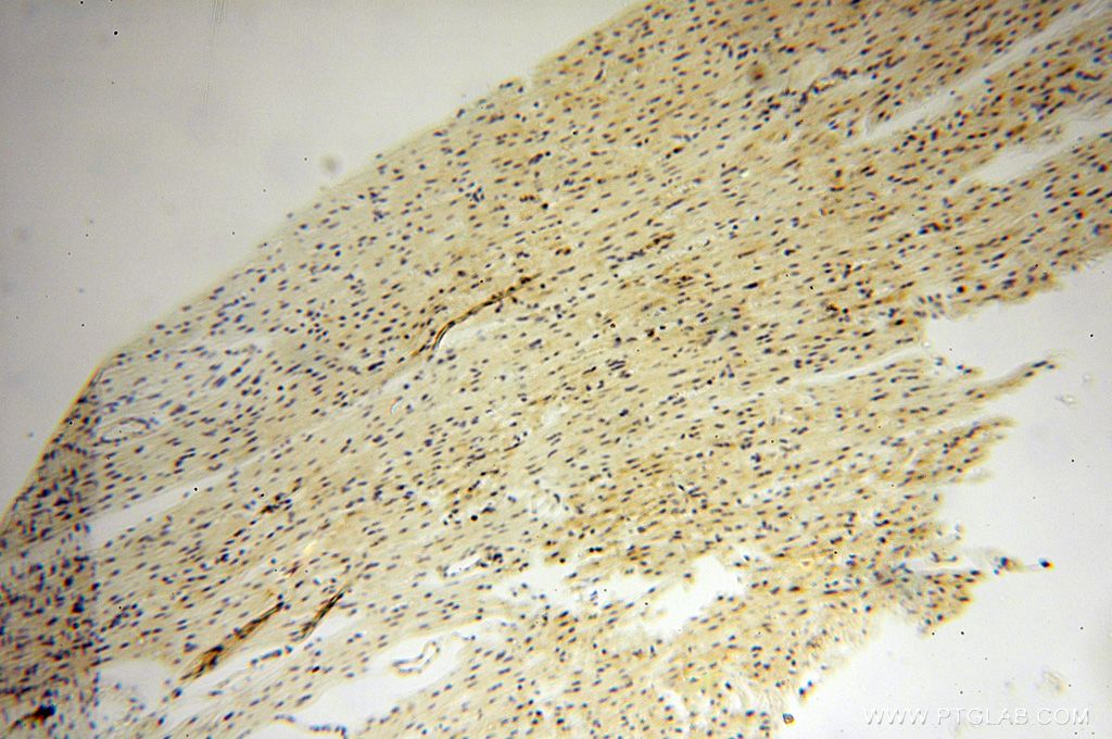 IHC staining of human heart using 17533-1-AP