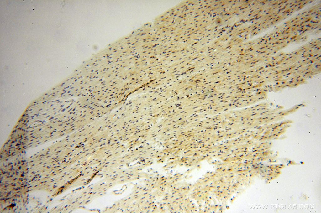 Immunohistochemistry (IHC) staining of human heart tissue using DNAI2 Polyclonal antibody (17533-1-AP)