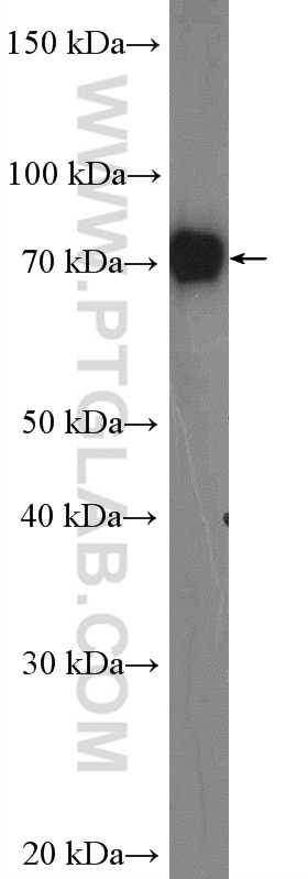 Western Blot (WB) analysis of mouse ovary tissue using DNAI2 Polyclonal antibody (17533-1-AP)