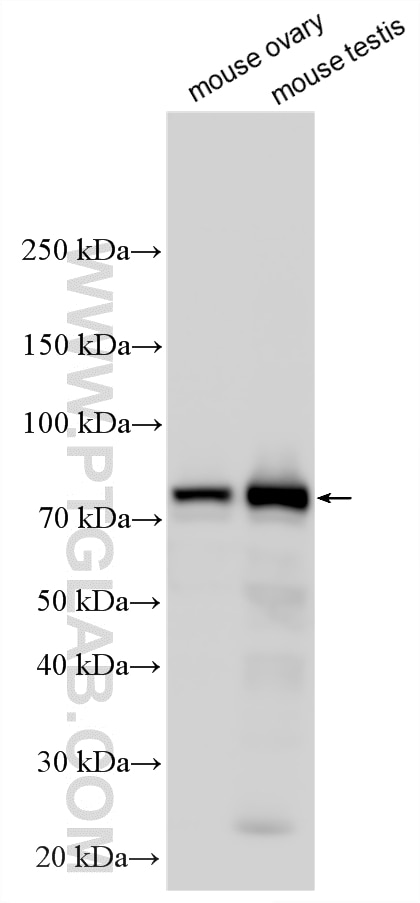 Western Blot (WB) analysis of various lysates using DNAI2 Polyclonal antibody (17533-1-AP)