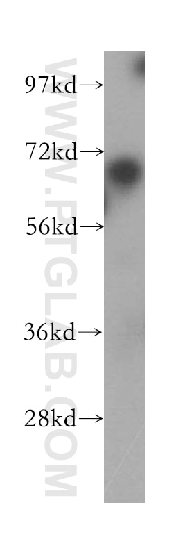 WB analysis of HeLa using 17533-1-AP