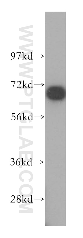 Western Blot (WB) analysis of mouse lung tissue using DNAI2 Polyclonal antibody (17533-1-AP)