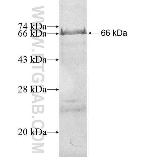 DNAI2 fusion protein Ag11585 SDS-PAGE
