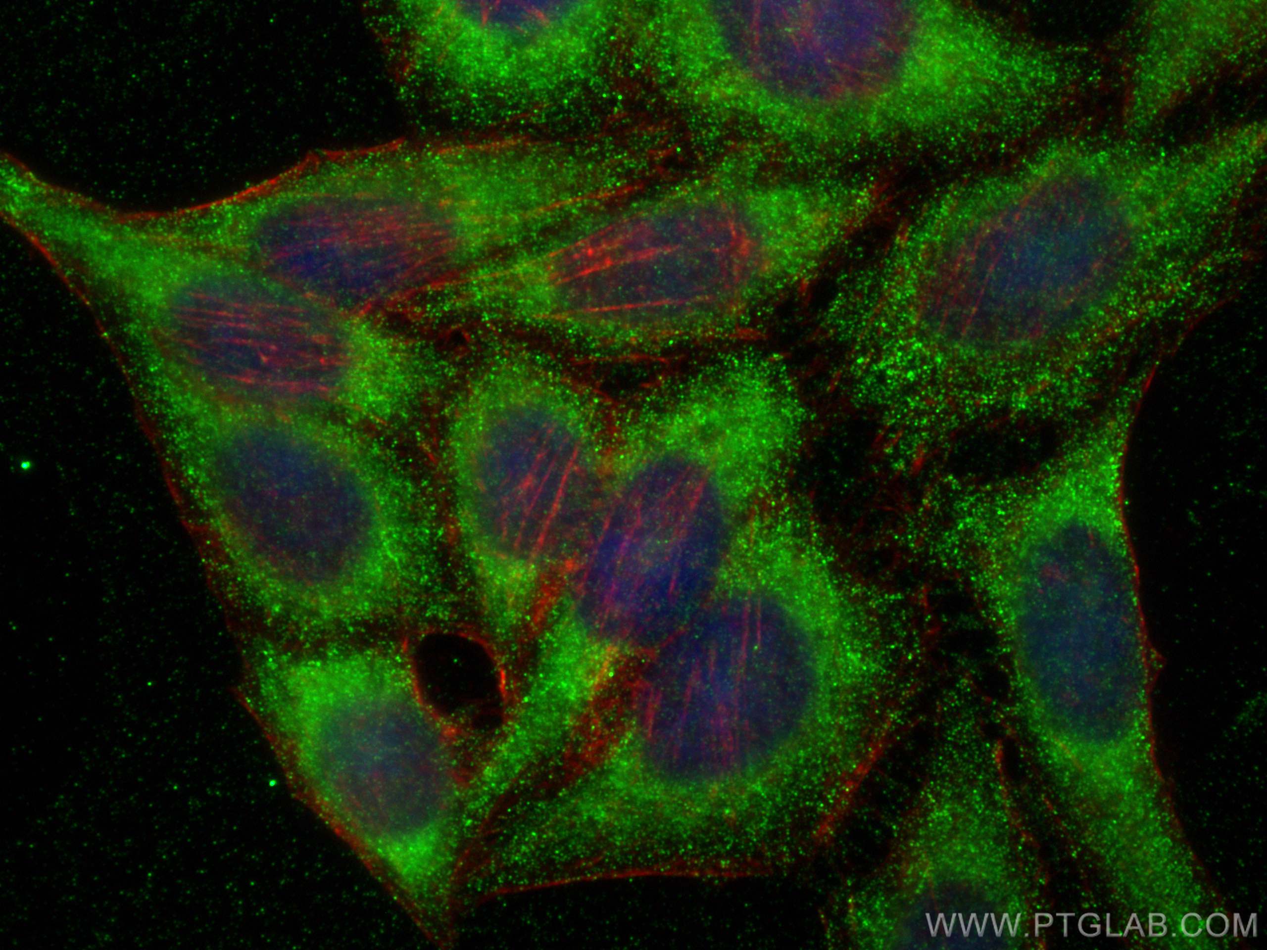 Immunofluorescence (IF) / fluorescent staining of HepG2 cells using DNAJA1 Polyclonal antibody (11713-1-AP)