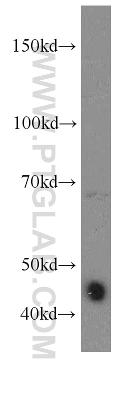 Western Blot (WB) analysis of human testis tissue using DNAJA1 Polyclonal antibody (11713-1-AP)
