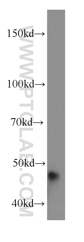 Western Blot (WB) analysis of human liver tissue using DNAJA1 Polyclonal antibody (11713-1-AP)