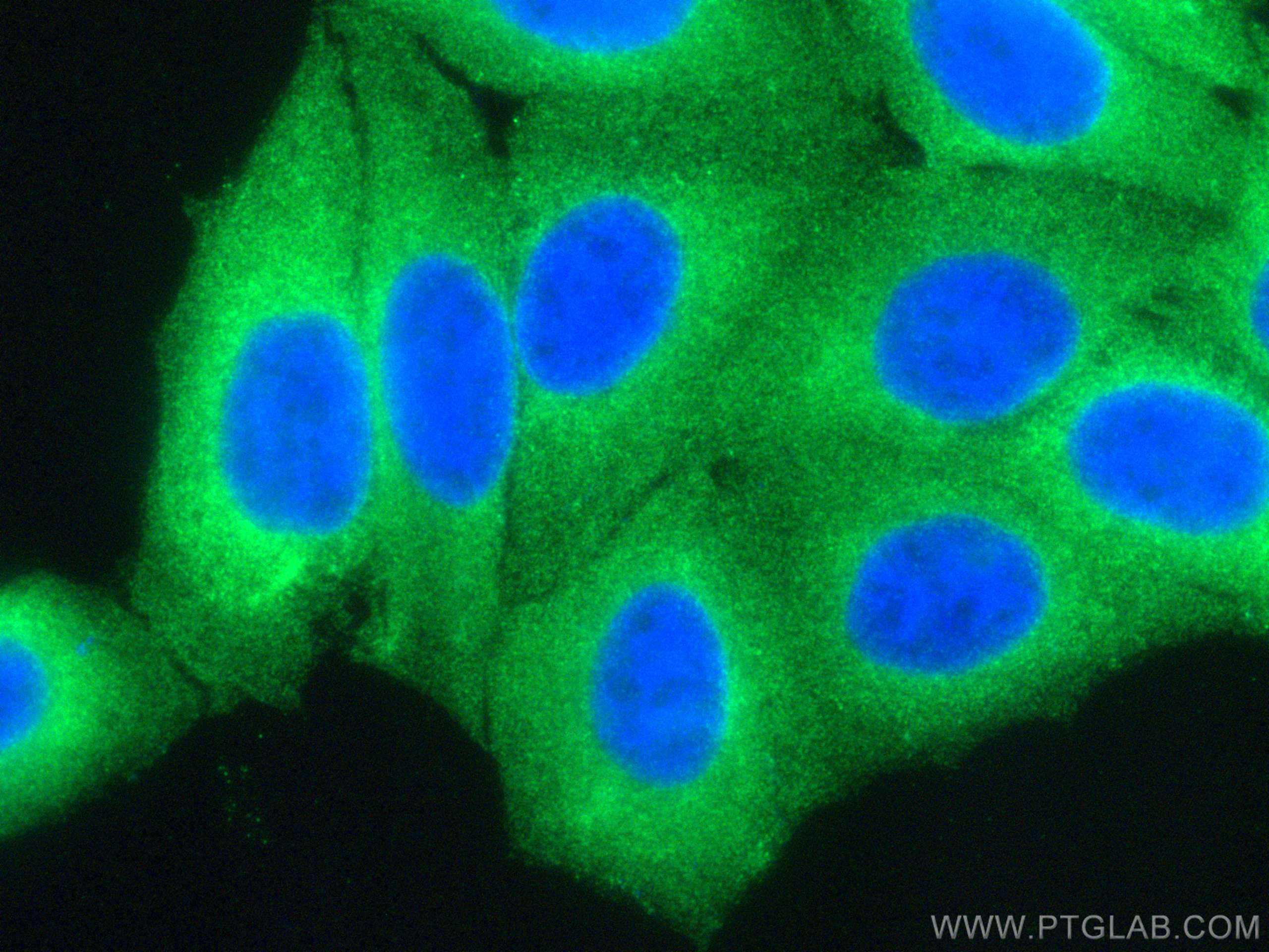 Immunofluorescence (IF) / fluorescent staining of HepG2 cells using DNAJA1 Monoclonal antibody (67184-1-Ig)