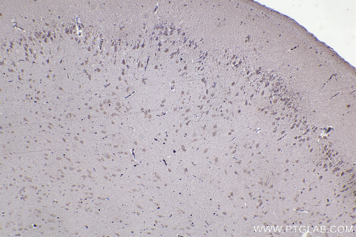 Immunohistochemistry (IHC) staining of rat brain tissue using DNAJA1 Monoclonal antibody (67184-1-Ig)