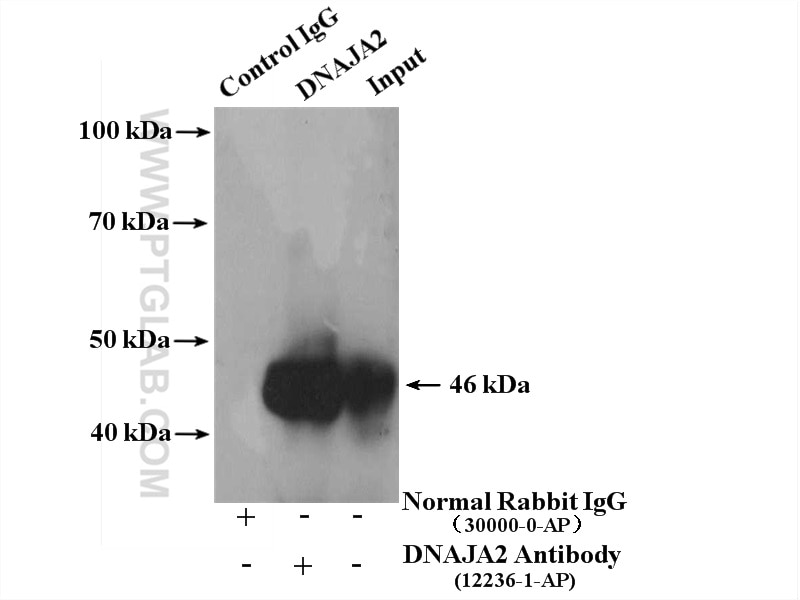 Immunoprecipitation (IP) experiment of A375 cells using DNAJA2 Polyclonal antibody (12236-1-AP)