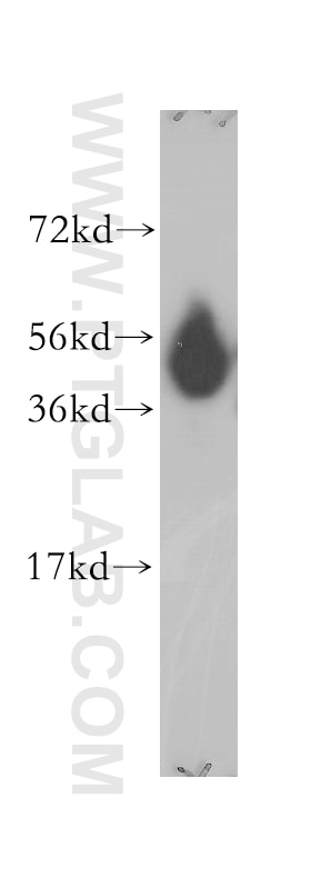 Western Blot (WB) analysis of human brain tissue using DNAJA2 Polyclonal antibody (12236-1-AP)