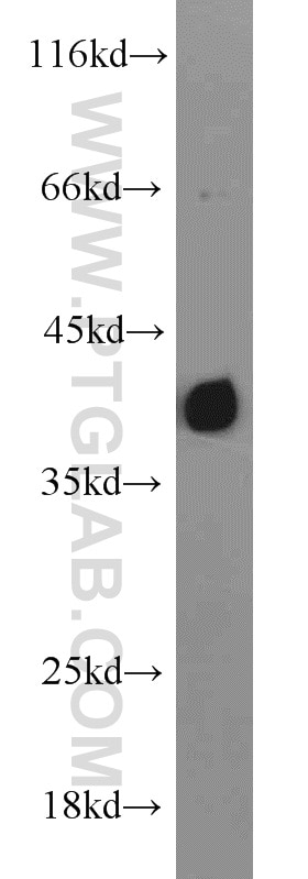 Western Blot (WB) analysis of K-562 cells using TID1 Polyclonal antibody (11088-1-AP)