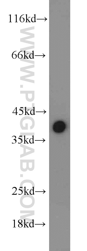 Western Blot (WB) analysis of Jurkat cells using TID1 Polyclonal antibody (11088-1-AP)