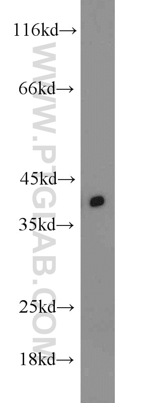 Western Blot (WB) analysis of Jurkat cells using TID1 Polyclonal antibody (11088-1-AP)