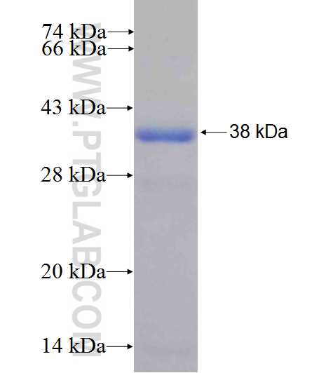 DNAJA3 fusion protein Ag26556 SDS-PAGE