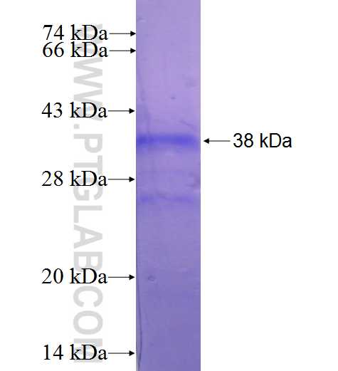DNAJA3 fusion protein Ag1558 SDS-PAGE
