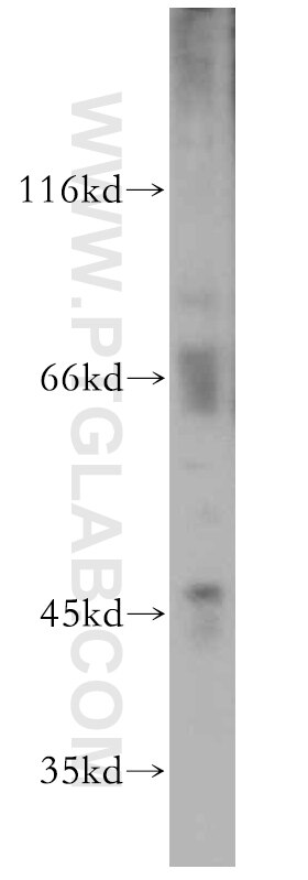 Western Blot (WB) analysis of mouse brain tissue using DNAJA4 Polyclonal antibody (12806-1-AP)