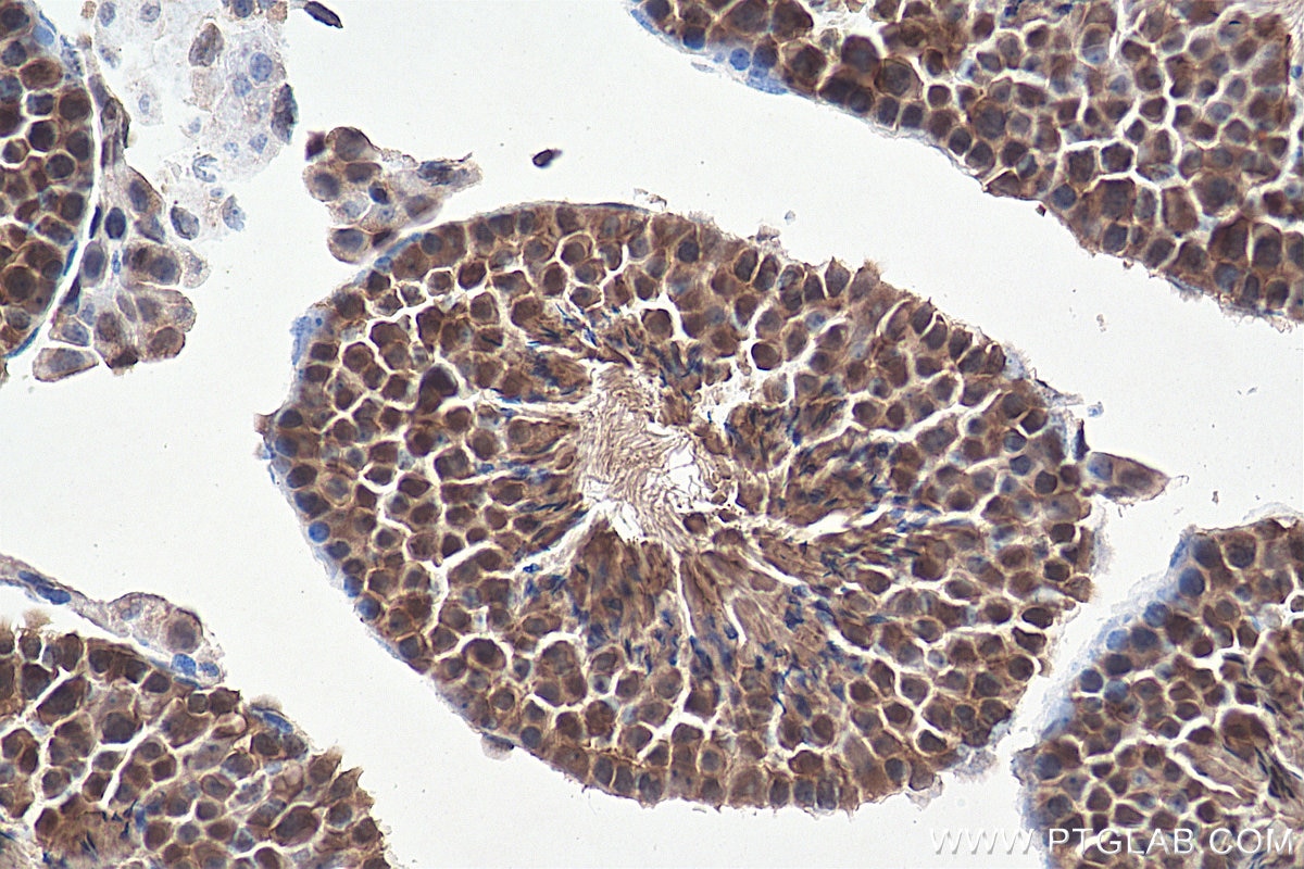 IHC staining of mouse testis using 13174-1-AP