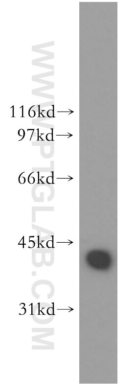 DNAJB1 Polyclonal antibody