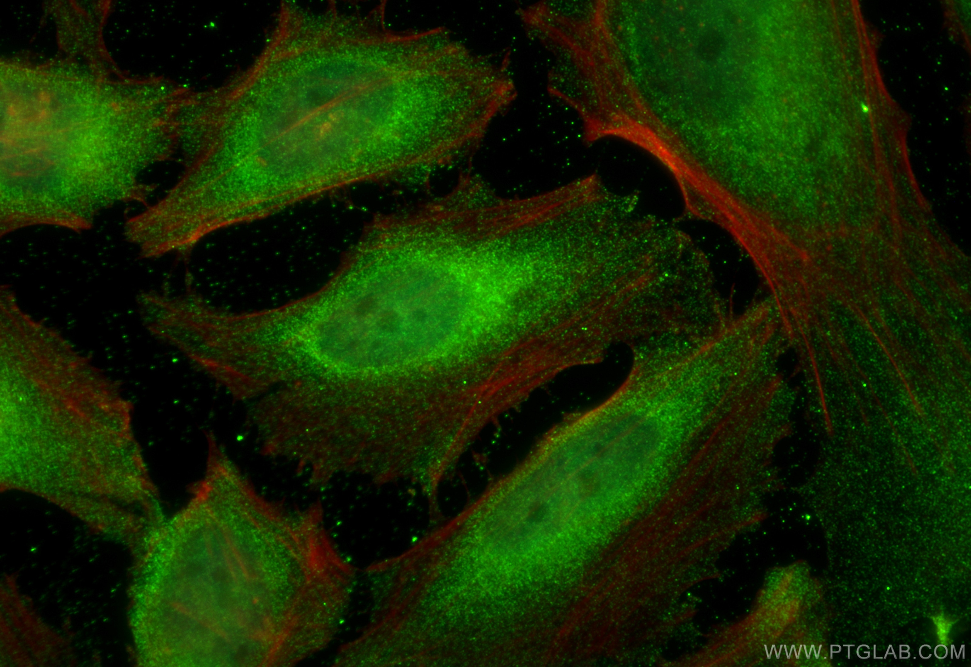 Immunofluorescence (IF) / fluorescent staining of HeLa cells using DNAJB1 Monoclonal antibody (67422-1-Ig)