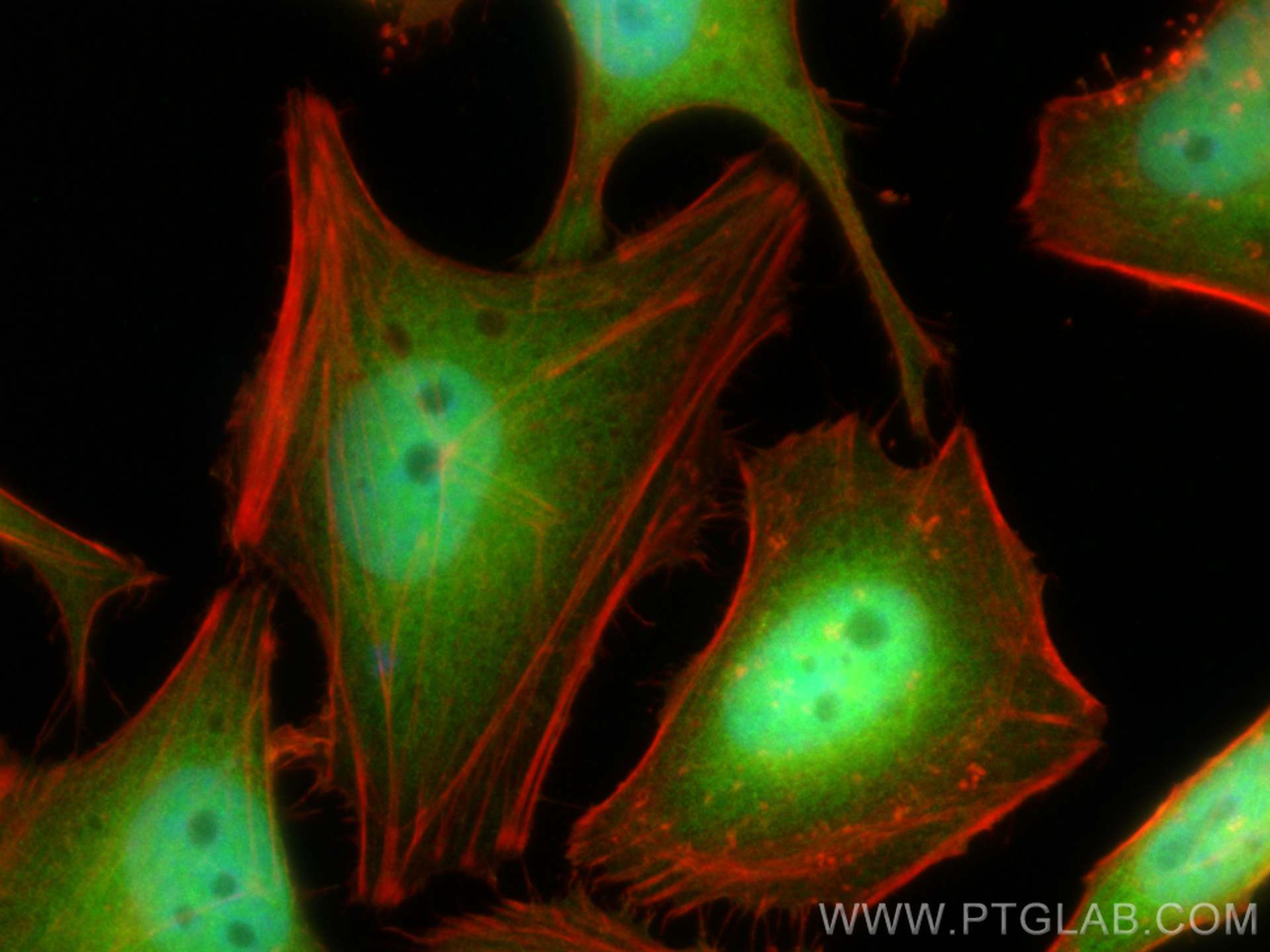 Immunofluorescence (IF) / fluorescent staining of HeLa cells using DNAJB1 Recombinant antibody (82676-1-RR)