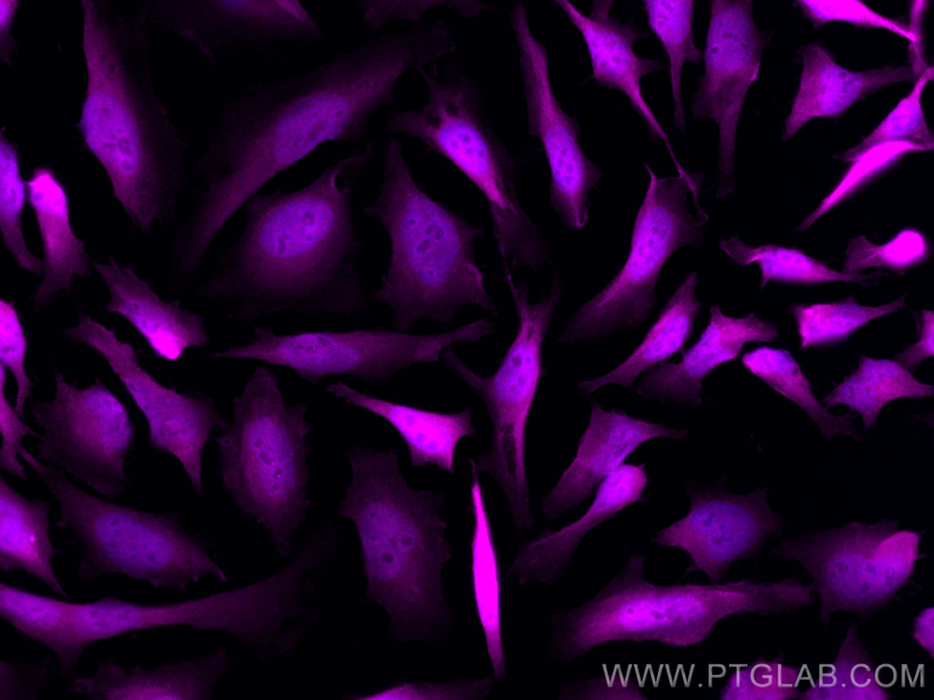 Immunofluorescence (IF) / fluorescent staining of HeLa cells using CoraLite® Plus 647-conjugated DNAJB1 Polyclonal an (CL647-13174)