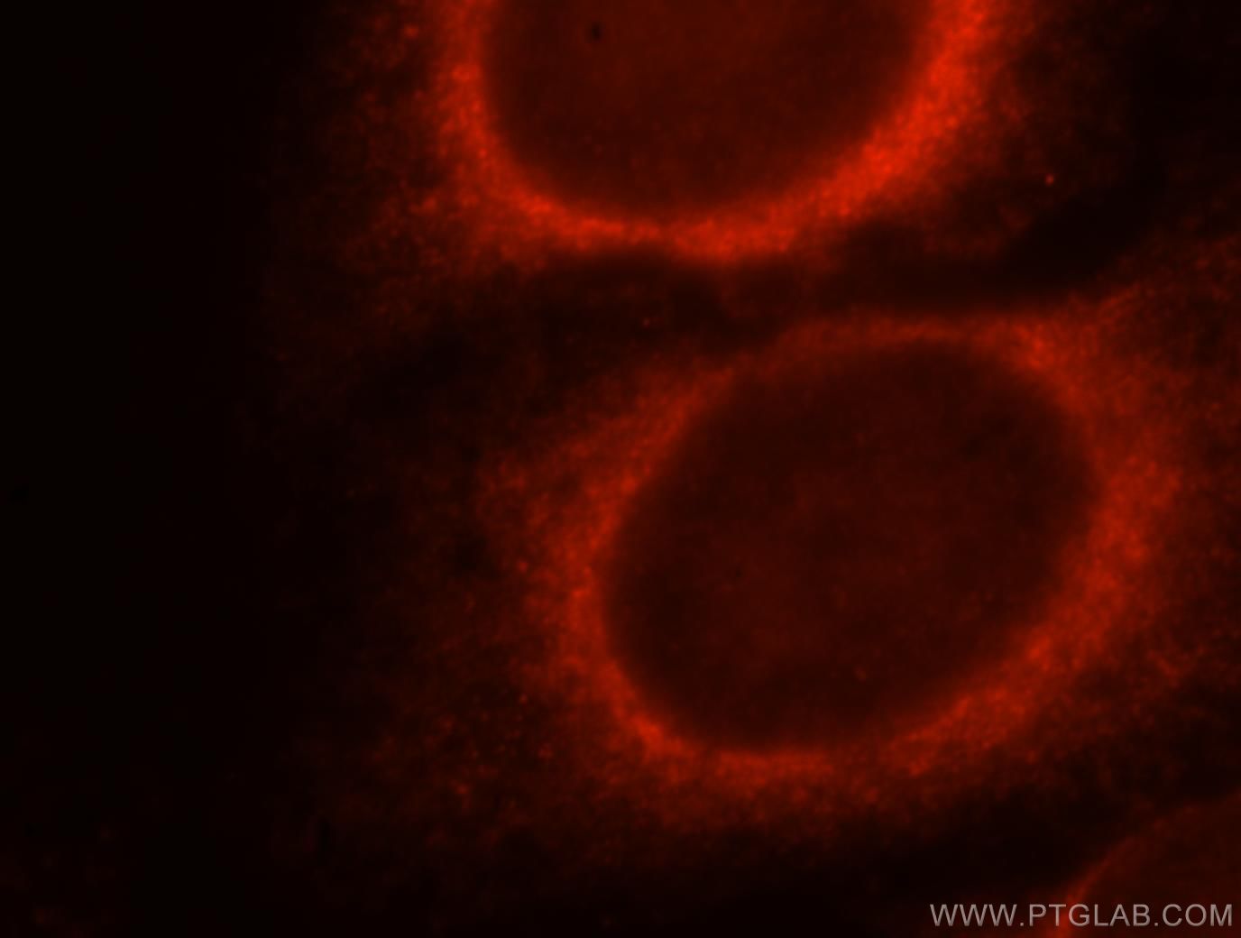 Immunofluorescence (IF) / fluorescent staining of HepG2 cells using DNAJB11 Polyclonal antibody (15484-1-AP)