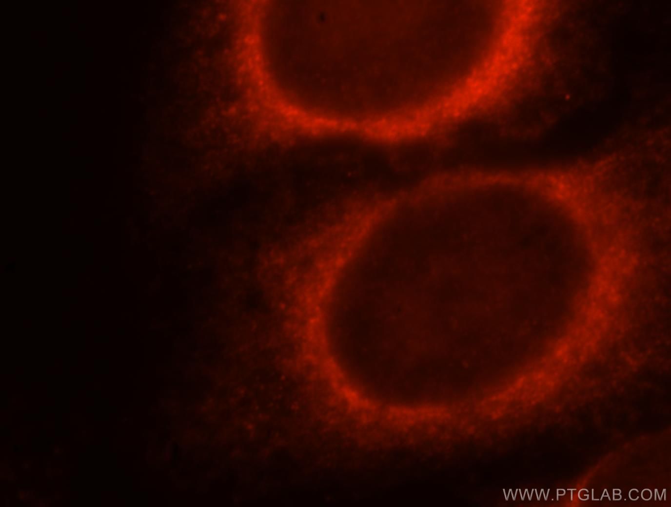 IF Staining of HepG2 using 15484-1-AP