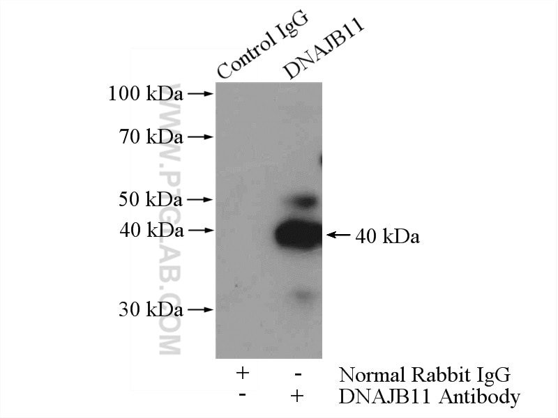 Immunoprecipitation (IP) experiment of mouse heart tissue using DNAJB11 Polyclonal antibody (15484-1-AP)