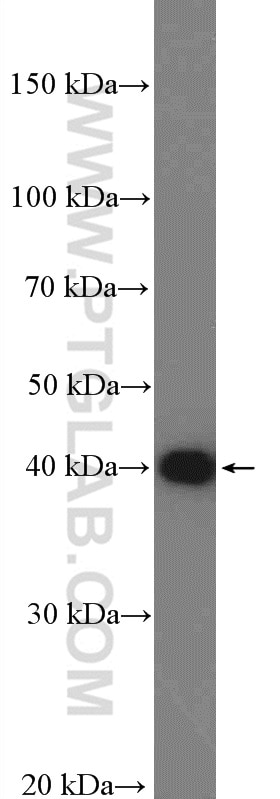 WB analysis of mouse liver using 15484-1-AP