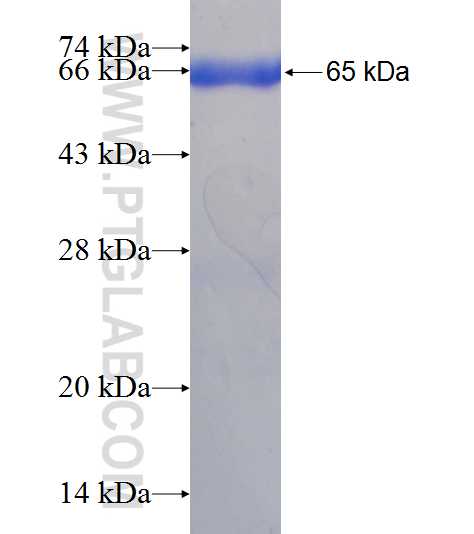 DNAJB11 fusion protein Ag7832 SDS-PAGE
