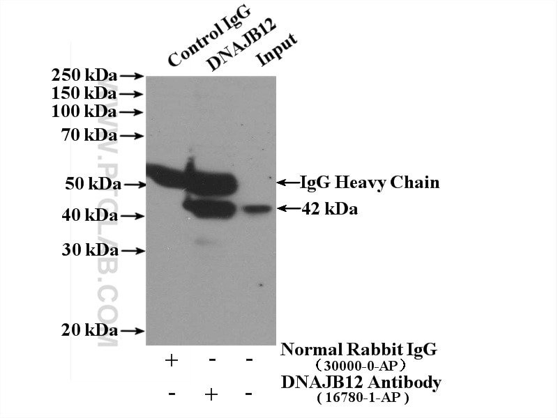 Immunoprecipitation (IP) experiment of mouse brain tissue using DNAJB12 Polyclonal antibody (16780-1-AP)