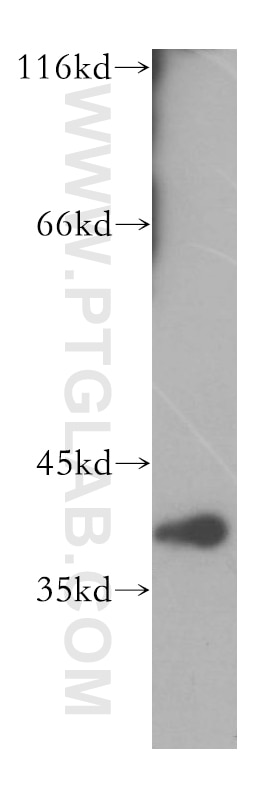 Western Blot (WB) analysis of human brain tissue using DNAJB12 Polyclonal antibody (16780-1-AP)