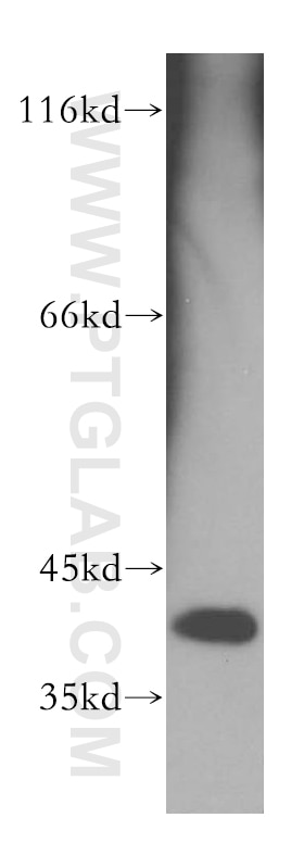 Western Blot (WB) analysis of human kidney tissue using DNAJB12 Polyclonal antibody (16780-1-AP)