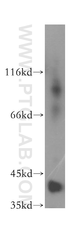 Western Blot (WB) analysis of human liver tissue using DNAJB12 Polyclonal antibody (16780-1-AP)