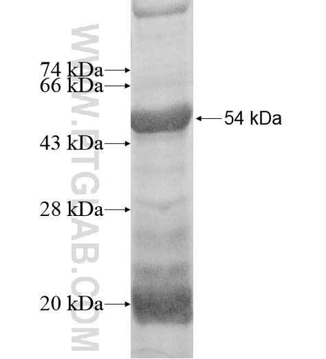 DNAJB12 fusion protein Ag10193 SDS-PAGE