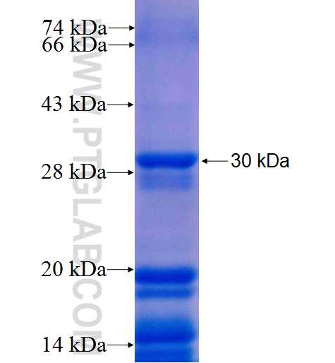 DNAJB12 fusion protein Ag9225 SDS-PAGE DNAJB12 fusion protein Ag9225 SDS-PAGE