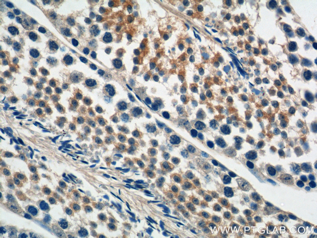 Immunohistochemistry (IHC) staining of mouse testis tissue using DNAJB13 Polyclonal antibody (25118-1-AP)