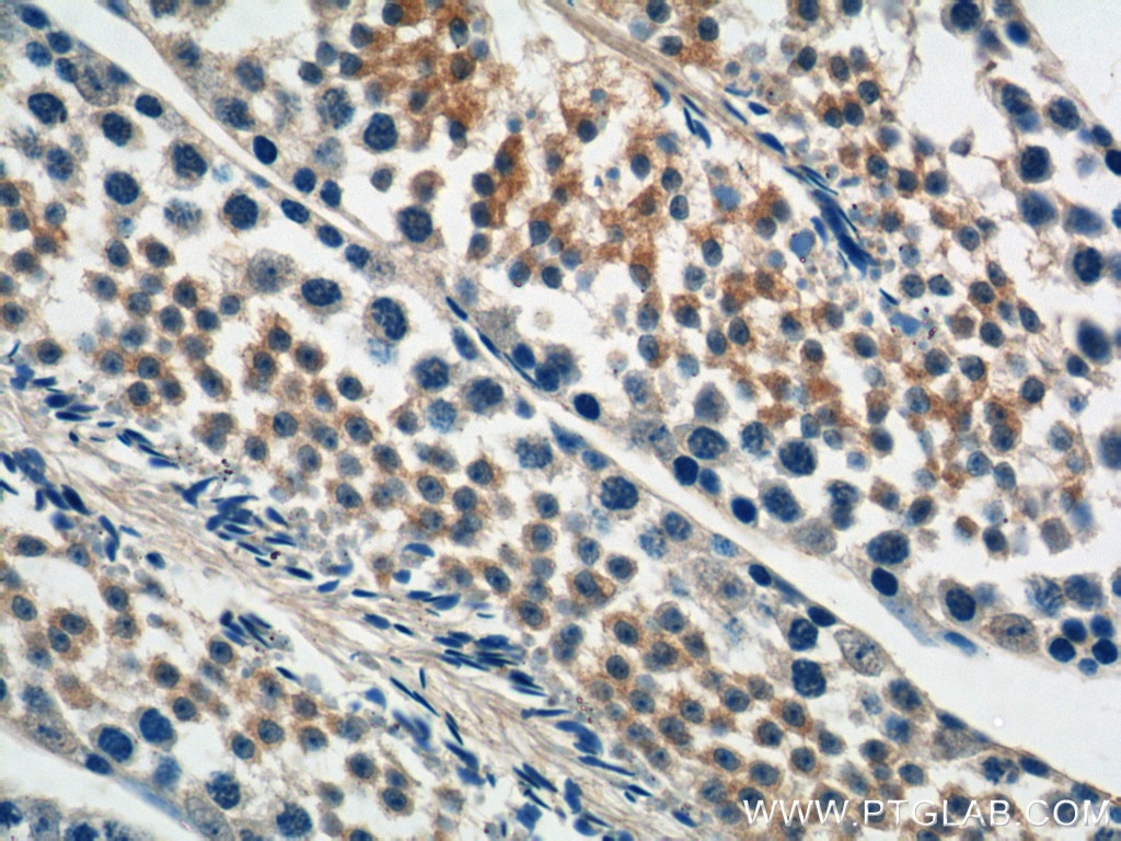 IHC staining of mouse testis using 25118-1-AP