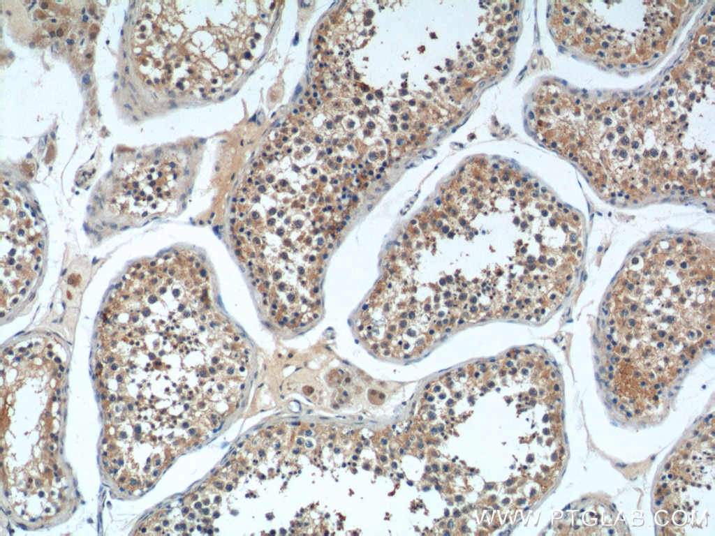 IHC staining of human testis using 25118-1-AP