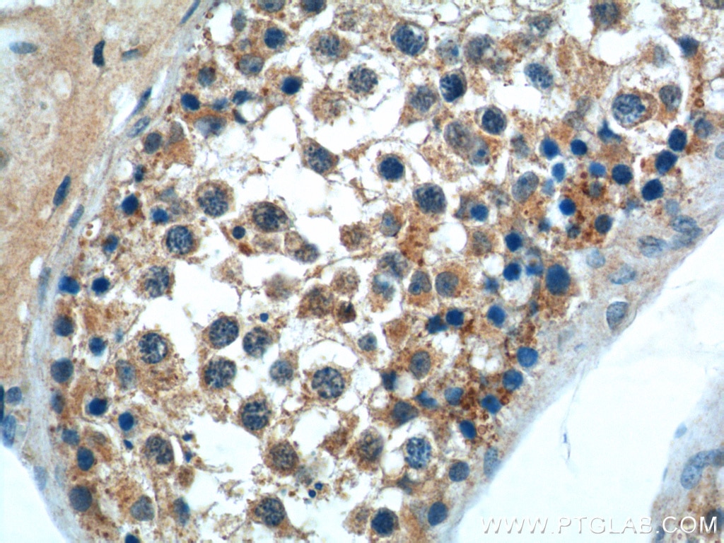 Immunohistochemistry (IHC) staining of human testis tissue using DNAJB13 Polyclonal antibody (25118-1-AP)