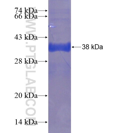 DNAJB13 fusion protein Ag18934 SDS-PAGE