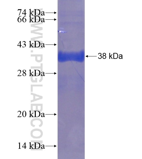 DNAJB13 fusion protein Ag18934 SDS-PAGE