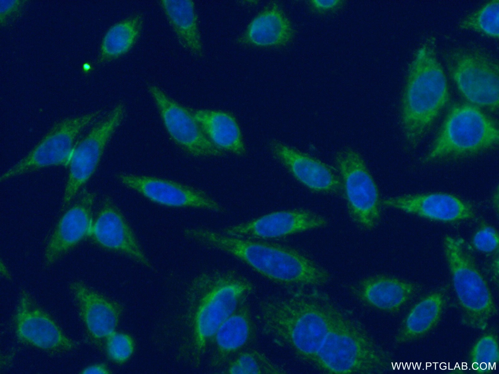 Immunofluorescence (IF) / fluorescent staining of HeLa cells using DNAJB14 Polyclonal antibody (16501-1-AP)