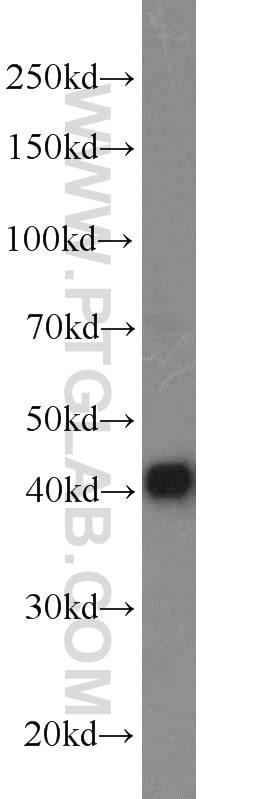 Western Blot (WB) analysis of Jurkat cells using DNAJB14 Polyclonal antibody (16501-1-AP)
