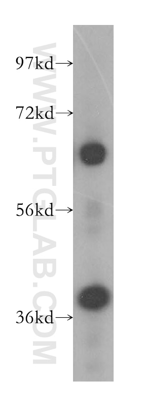 Western Blot (WB) analysis of HeLa cells using DNAJB14 Polyclonal antibody (16501-1-AP)