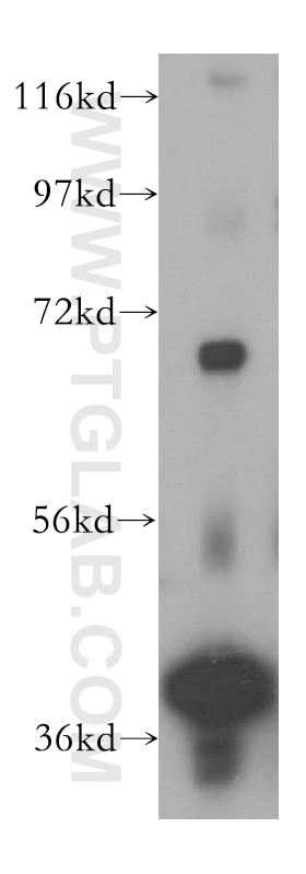 Western Blot (WB) analysis of human testis tissue using DNAJB14 Polyclonal antibody (16501-1-AP)